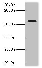 DDX19A Polyclonal Antibody (100 µl)
