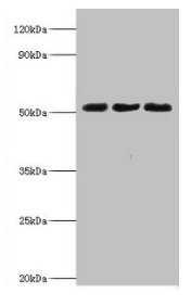 BAG5 Polyclonal Antibody (50 µl)