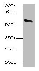 CYP11A1 Polyclonal Antibody (100 µl)