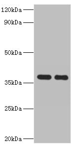 GALM Polyclonal Antibody (50 µl)