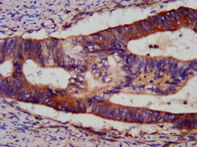 BID Polyclonal Antibody (100 µl)