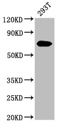 AFP Polyclonal Antibody (50 µl)