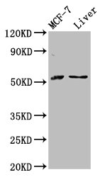 AKT2 Polyclonal Antibody (100 µl)