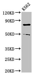 PADI2 Polyclonal Antibody (100 µl)