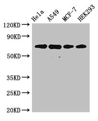 XRCC6 Polyclonal Antibody (100 µl)