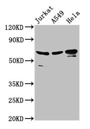 AIFM1 Polyclonal Antibody (20 µl)