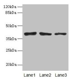 ATP6AP2 Polyclonal Antibody (100 µl)
