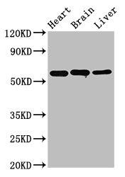 ALDH5A1 Polyclonal Antibody (100 µl)