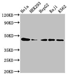 CSNK2A1 Polyclonal Antibody (100 µl)