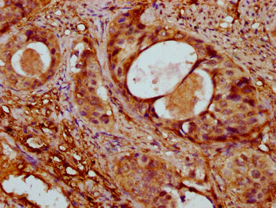 Actin, Alpha Skeletal Muscle Polyclonal Antibody (50 µl)