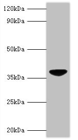 Apoptin Polyclonal Antibody (100 µl)