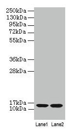 B2M Polyclonal Antibody (100 µl)