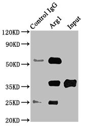 Arg1 Polyclonal Antibody (100 µl)