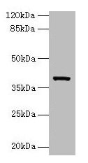 Arg2 Polyclonal Antibody (100 µl)