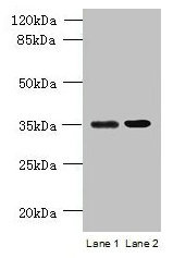 CCDC108 Polyclonal Antibody (100 µl)