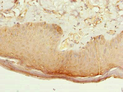 CMTR2 Polyclonal Antibody (20 µl)