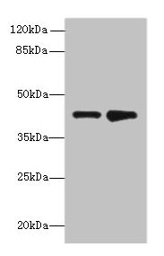 ELAVL4 Polyclonal Antibody (100 µl)