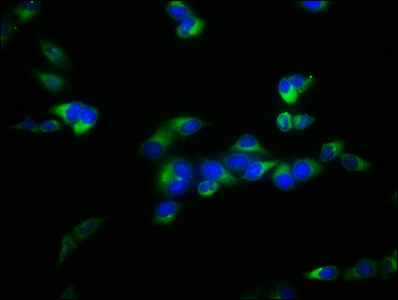 FBXL2 Polyclonal Antibody (50 µl)