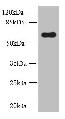 GDPD2 Polyclonal Antibody (100 µl)