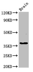 GHITM Polyclonal Antibody (100 µl)