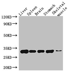GPM6A Polyclonal Antibody (20 µl)