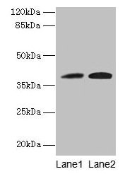 KLHDC8A Polyclonal Antibody (100 µl)