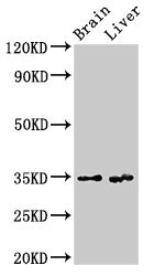 RBKS Polyclonal Antibody | EpigenTek