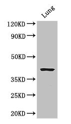 CYSLTR1 Polyclonal Antibody (100 µl)