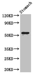 ENTPD8 Polyclonal Antibody (100 µl)
