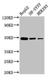FDFT1 Polyclonal Antibody (100 µl)
