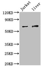 KLHL2 Polyclonal Antibody (100 µl)