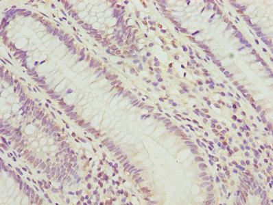 PLK1 Polyclonal Antibody (100 µl)