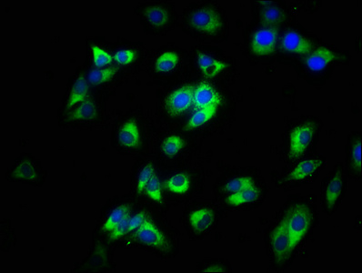 CD14 Polyclonal Antibody (20 µl)