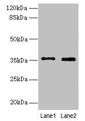 FOXR2 Polyclonal Antibody (100 µl)
