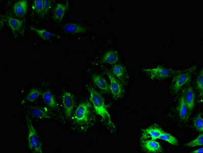 CYP2U1 Polyclonal Antibody (20 µl)