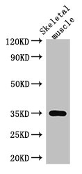 ANKRD23 Polyclonal Antibody (100 µl)