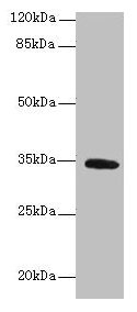 SETD9 Polyclonal Antibody (100 µl)