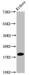 NAA38 Polyclonal Antibody (100 µl)