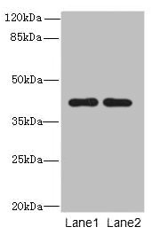 CIPC Polyclonal Antibody (100 µl)