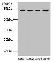 DHX35 Polyclonal Antibody (100 µl)