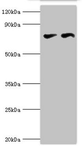 CTCF Polyclonal Antibody (50 µl)