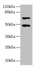 HDAC3 Polyclonal Antibody (100 µl)