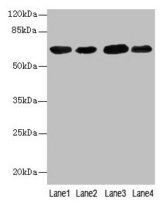 ESR1 Polyclonal Antibody (100 µl)