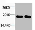 Histone H1 Polyclonal Antibody (50 µl)