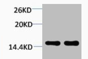 Histone H1K25me2 (H1K25 Dimethyl) Polyclonal Antibody (50 µl)
