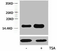 Histone H2AK5ac (Acetyl H2AK5) Polyclonal Antibody (50 µl)