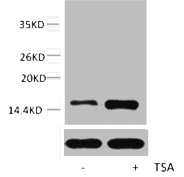 Histone H2A.ZK7ac (Acetyl H2A.ZK7) Polyclonal Antibody (100 µl)