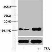 Histone H2BK12ac (Acetyl H2BK12) Polyclonal Antibody (50 µl)