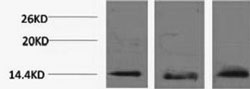 Histone H2BK5me3 (H2BK5 Trimethyl) Polyclonal Antibody (100 µl)