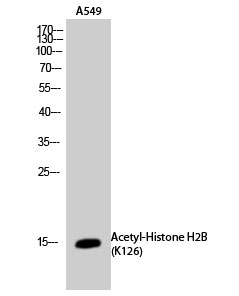 Histone H2BK126ac (Acetyl H2BK126) Polyclonal Antibody (100 µl)